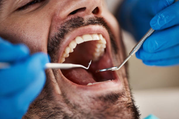 Best Dental Abscess Treatment in Black Mountain, NC
